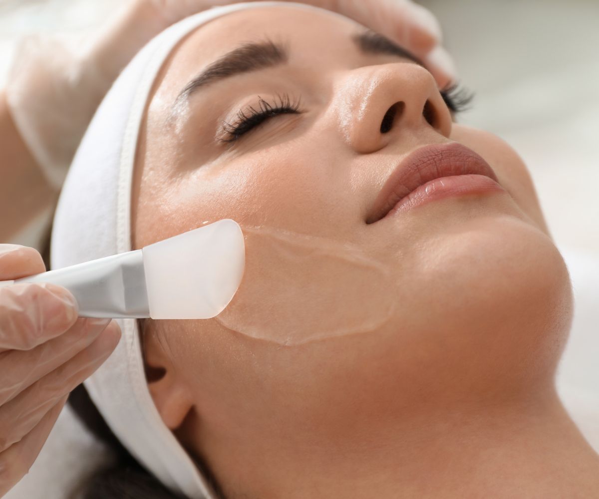 Peeling Chimici