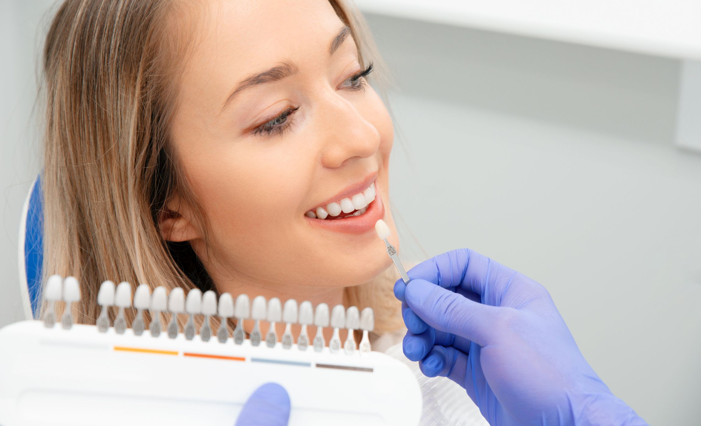 faccette dentali