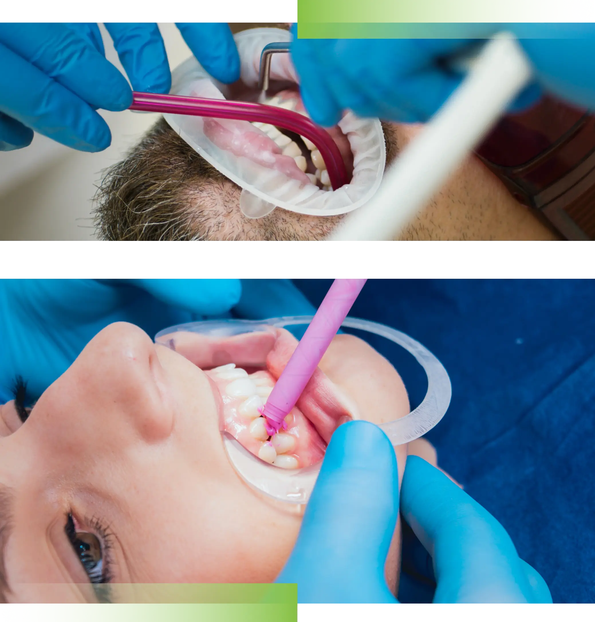 denti igiene